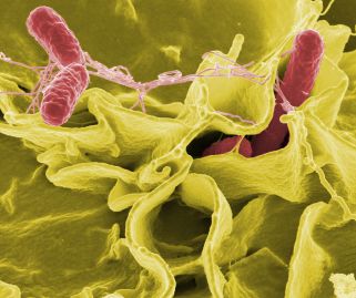 Salmonella bacteria, which is what we look like to aliens.